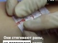 Замена медицинских швов